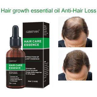 Oem Hair Growth Oil