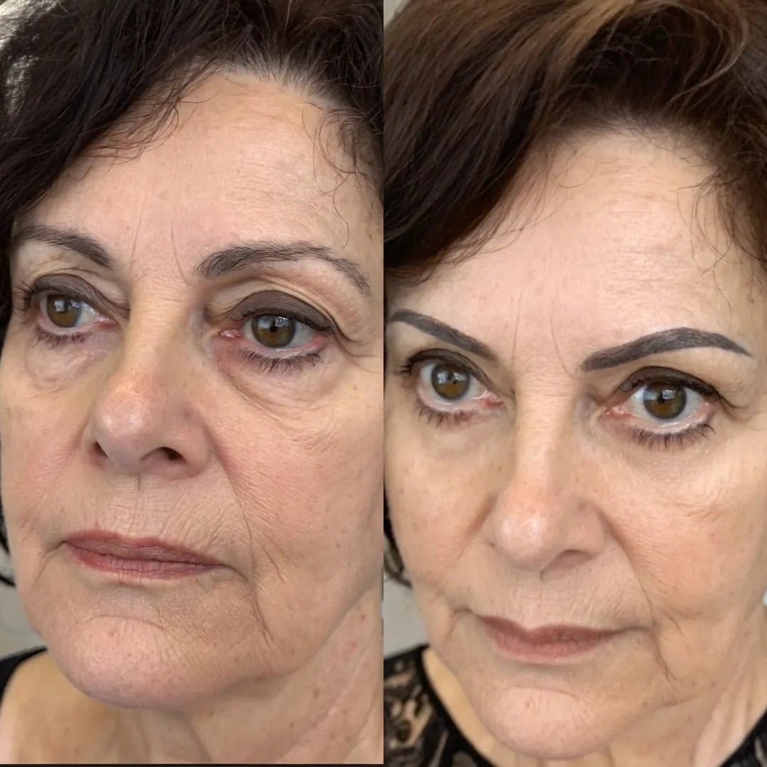 ReviveEyes folded flat