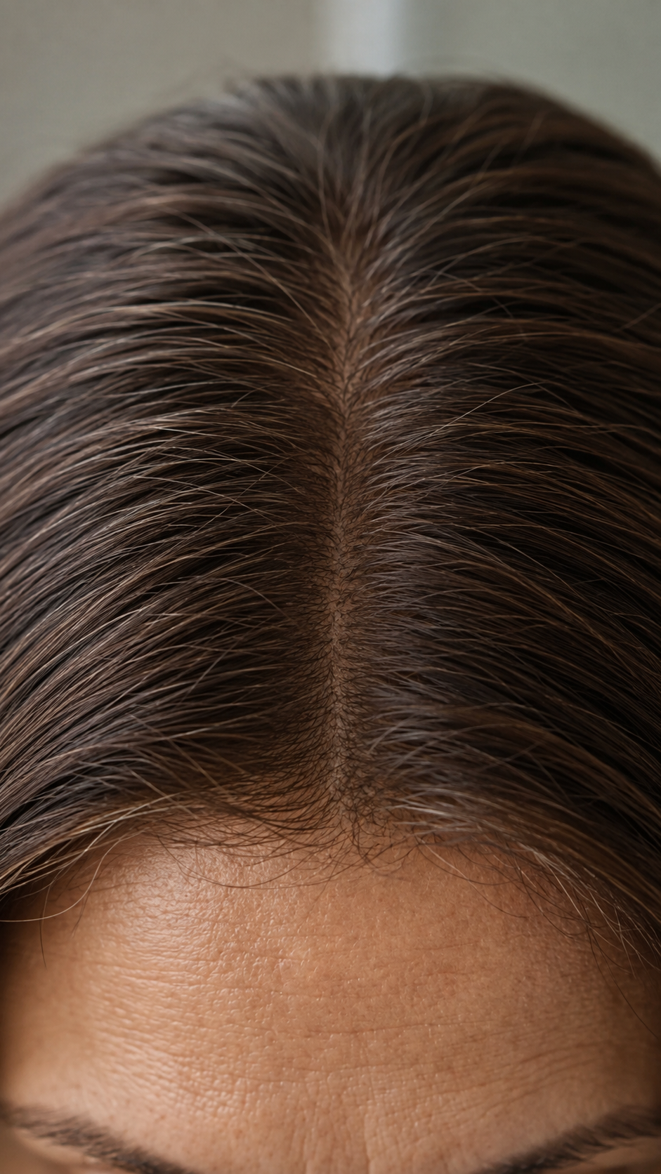 Gray roots — after