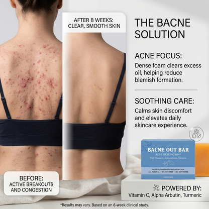 Clarifying Back & Body Bar