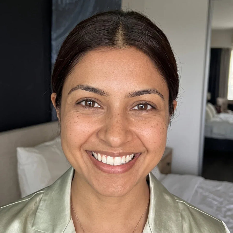 Uneven skin tone before applying the foundation