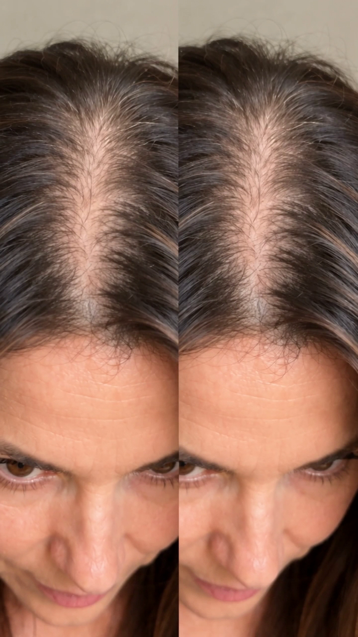 Visible scalp